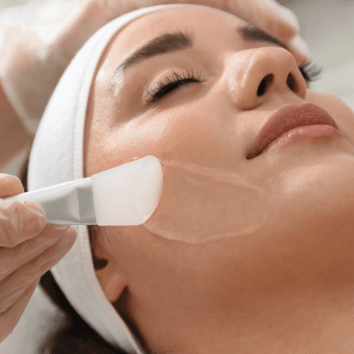 Embrace the Transformation Power of Chemical Peels